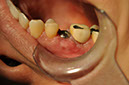 %_tempFileNameImplant%20113c8%