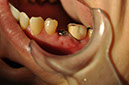 %_tempFileNameImplant%20113c9%