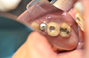 %_tempFileNameImplant%20113c91%
