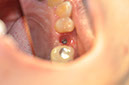 %_tempFileNameImplant%20113d1%