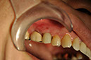 %_tempFileNameImplant%20113d3%