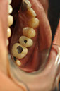 %_tempFileNameImplant%20113d4%