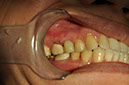%_tempFileNameImplant%20113d5%