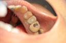 %_tempFileNameImplant%20113d6%