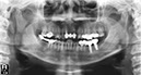 %_tempFileNameImplant%20113e1%