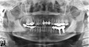 %_tempFileNameImplant%20113e2%