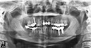 %_tempFileNameImplant%20113e3%