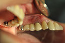 %_tempFileNameImplant%20115Ea1%