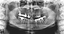 %_tempFileNameImplant%20115Ea2%