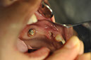 %_tempFileNameImplant%20115Ea3%