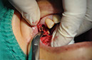 %_tempFileNameImplant%20115Ea5%