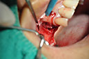%_tempFileNameImplant%20115Ea7%