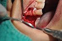 %_tempFileNameImplant%20115Ea8%