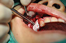 %_tempFileNameImplant%20115Eb8%