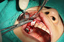 %_tempFileNameImplant%20115Eb9%