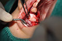 %_tempFileNameImplant%20115Ec1%