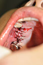%_tempFileNameImplant%20115Ec2%