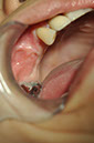 %_tempFileNameImplant%20115Ec3%