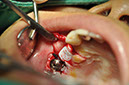 %_tempFileNameImplant%20115Ec4%