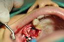 %_tempFileNameImplant%20115Ec5%