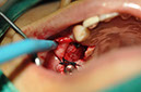 %_tempFileNameImplant%20115Ec6%