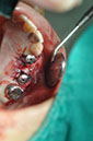 %_tempFileNameImplant%20115Ec7%
