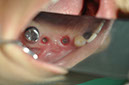 %_tempFileNameImplant%20115Ec9%