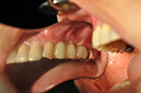 %_tempFileNameImplant%20115Ed2%
