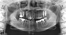 %_tempFileNameImplant%20115Ed3%