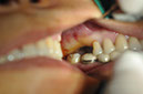 %_tempFileNameImplant%20115a1%