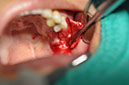 %_tempFileNameImplant%20115a2%