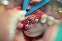 %_tempFileNameImplant%20115a3%