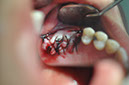 %_tempFileNameImplant%20115b1%