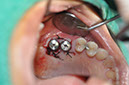 %_tempFileNameImplant%20115b4%