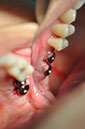 %_tempFileNameImplant%20115b5%