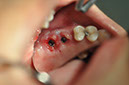 %_tempFileNameImplant%20115b6%