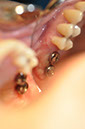 %_tempFileNameImplant%20115b7%