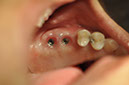 %_tempFileNameImplant%20115b8%