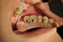 %_tempFileNameImplant%20115c1%