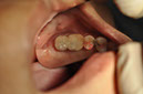 %_tempFileNameImplant%20115c3%