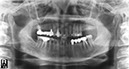%_tempFileNameImplant%20115d1%