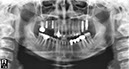 %_tempFileNameImplant%20115d2%