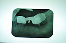 %_tempFileNameImplant%20116a2%