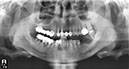 %_tempFileNameImplant%20116d2%
