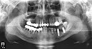 %_tempFileNameImplant%20116d4%