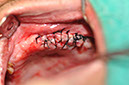 %_tempFileNameImplant%20118b2%