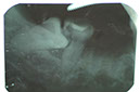 %_tempFileNameImplant%2011a2%