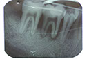 %_tempFileNameImplant%2011b4%