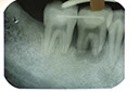 %_tempFileNameImplant%2011b5%