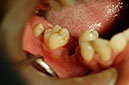 %_tempFileNameImplant%2011c1%